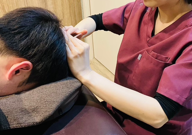 施術の様子